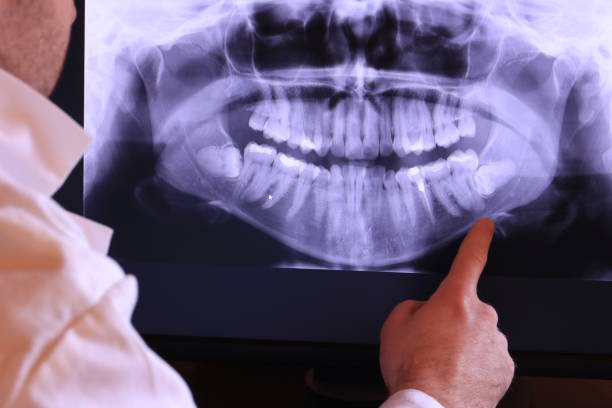Best Emergency Denture Repair in Westwood, NJ
